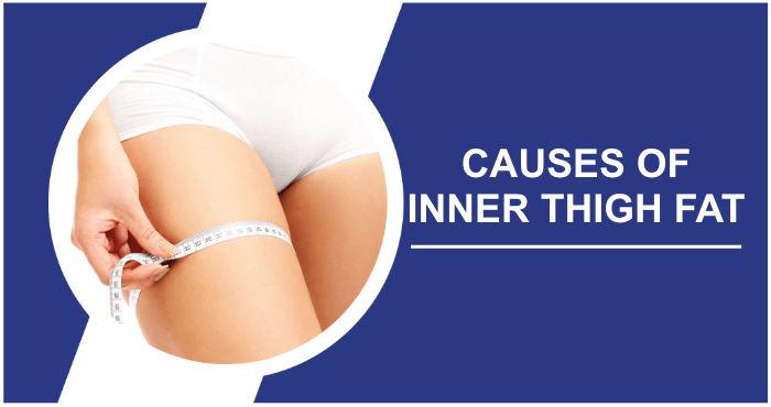 Causes of inner thigh fat